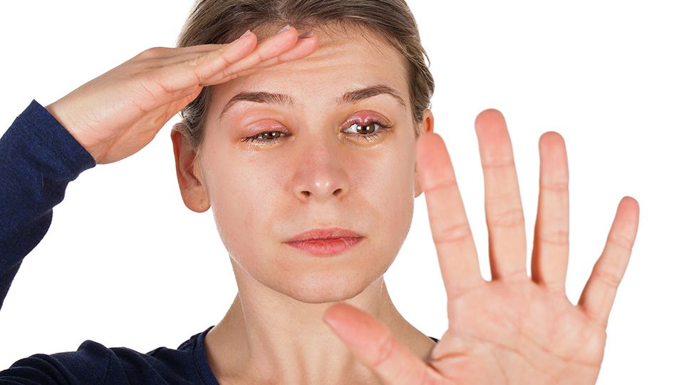 woman with eyelid problems