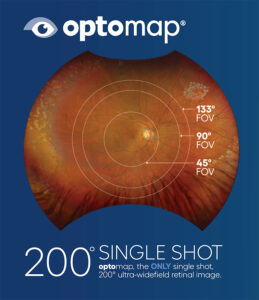 optomap