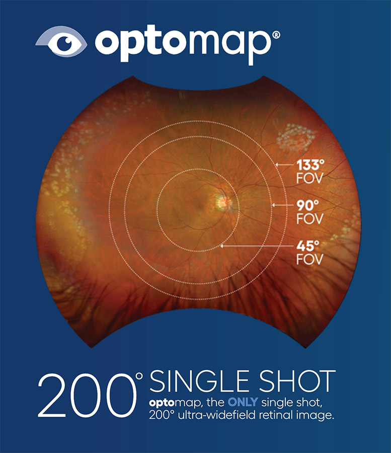 optomap